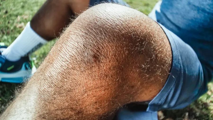 Is running safe for knee osteoarthritis Bangalore — knee joint anatomy and cartilage protection during recreational running, evaluated at Pro Physiotherapy JP Nagar sports physiotherapy